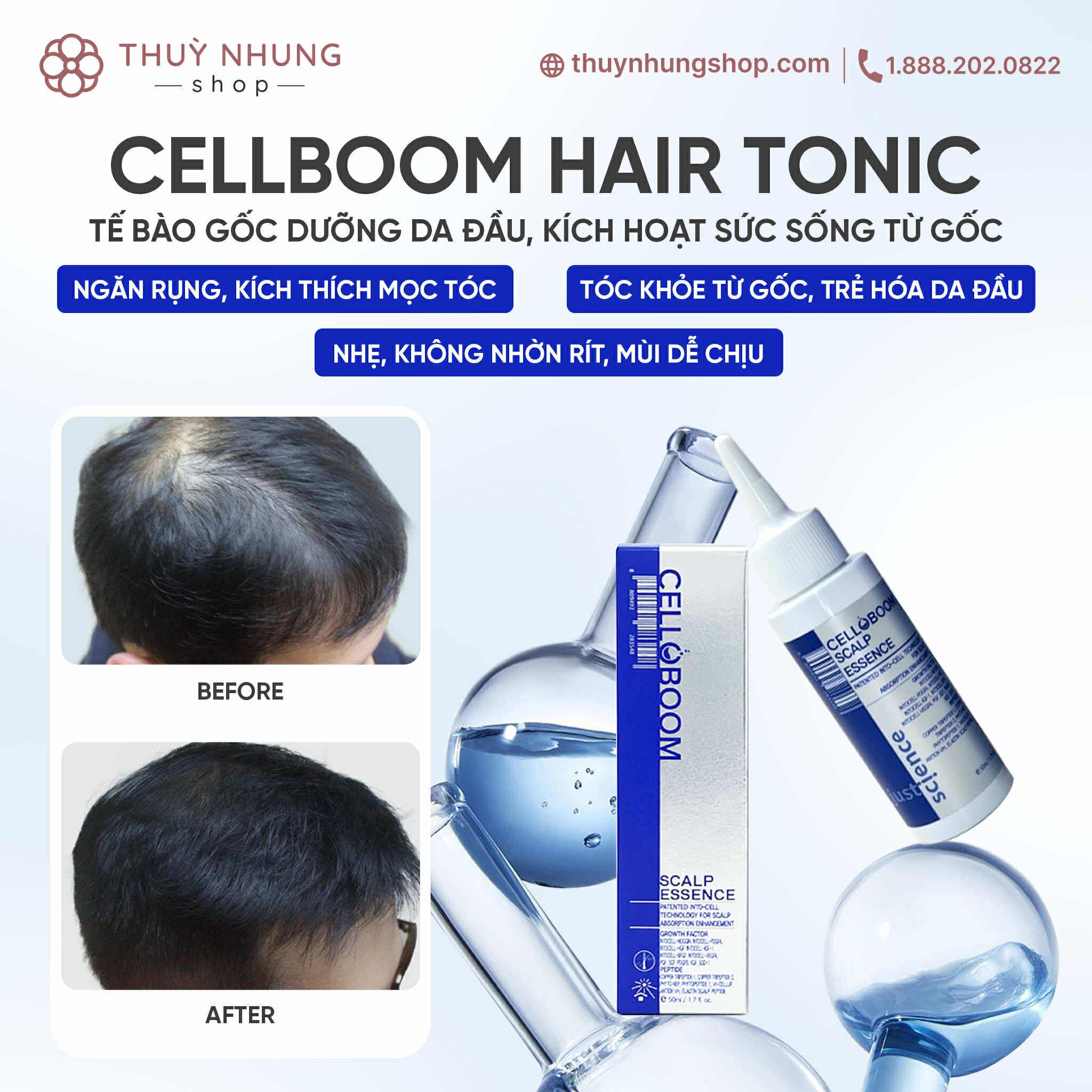 [ Some by mi ] CICA Peptide Chống Rụng Tóc Derma Scalp Tonic 150ml