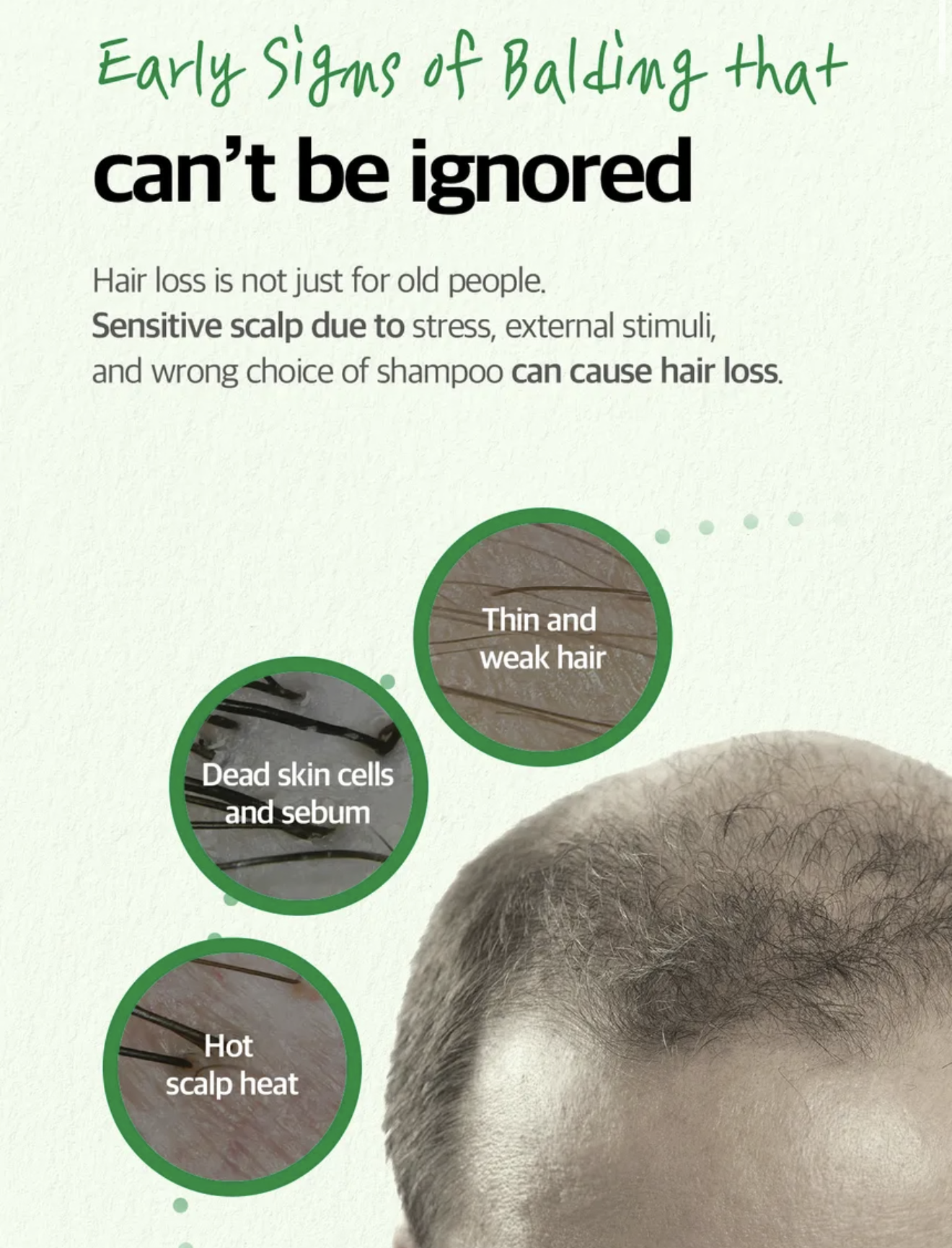 [SOME BY MI] Cica Peptide Anti Hair Loss Derma Scalp Tonic