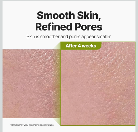 [P.CALM] Holy Basil Bubble Deep Mask