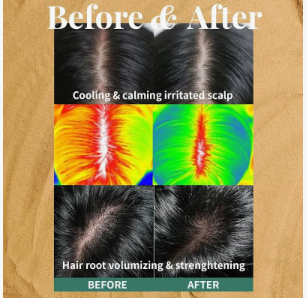 [PLU] Therapy Scalp Scaling Scrub